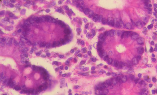 Cells of the lining of the small intestine