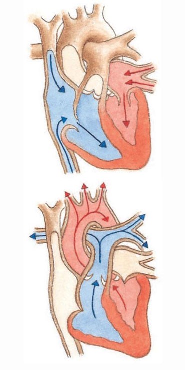 Blood enters the heart (top) and leaves it (above)