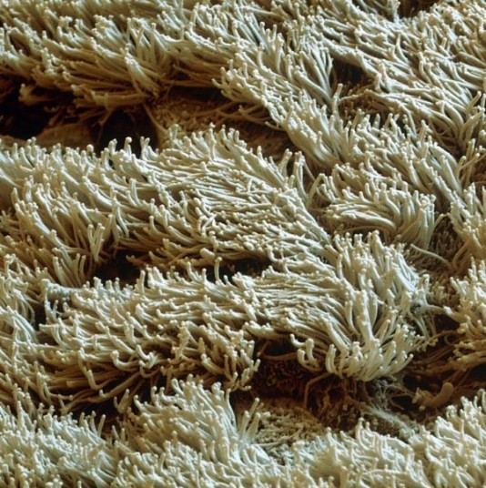 Cilia—tiny hairs—lining the inside of the nose