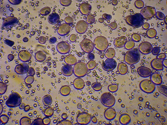 Starch granules, seen through a microscope