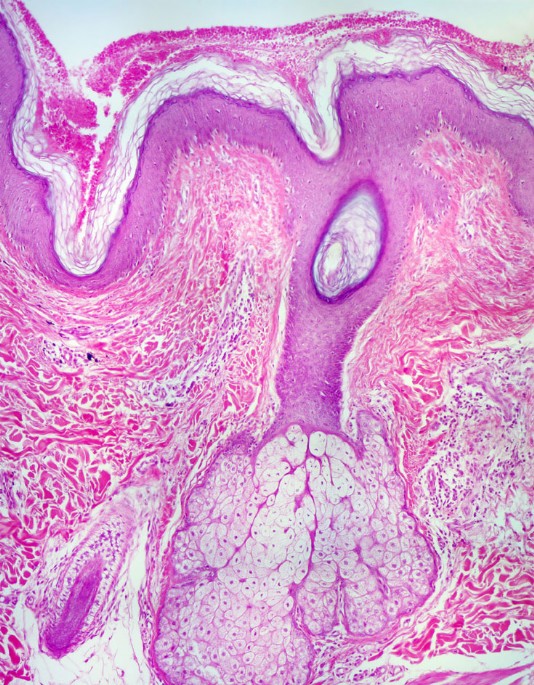 Photo of a sweat gland