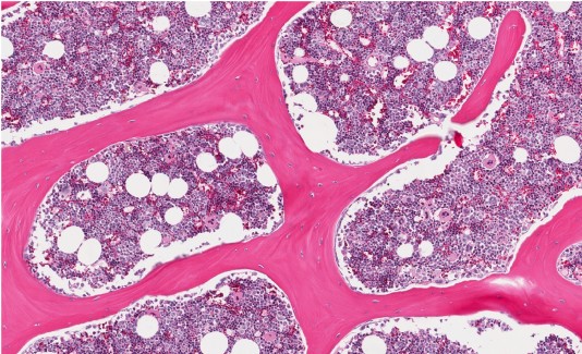 Bone marrow as seen through the microscope