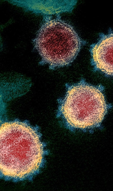 Electron micrograph of Sars-CoV-2viruses 