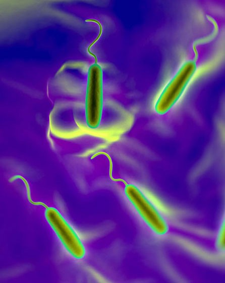 Vibrio cholerae bacteria under a microscope