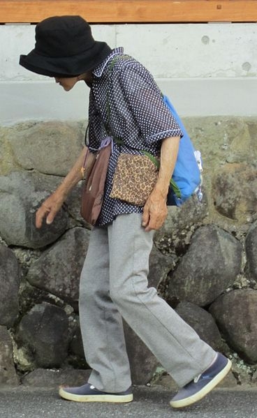An elderly women with osteoporosis