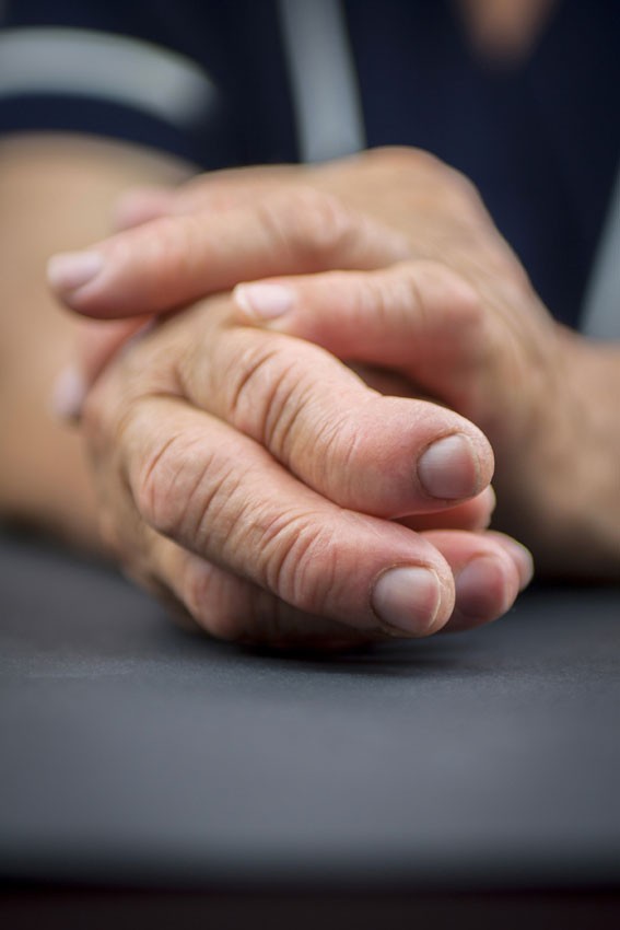 Rheumatoid arthritis