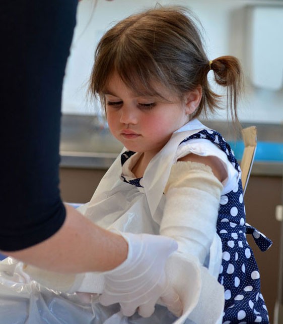 Applying a plaster cast to a broken arm