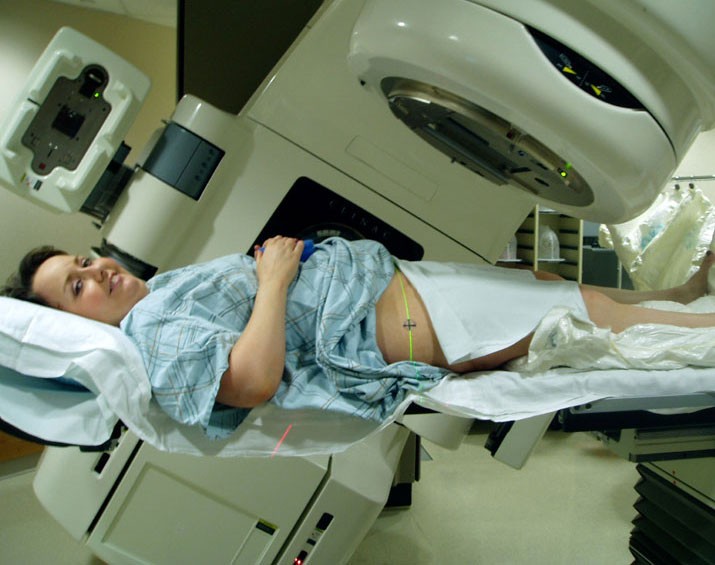 Radiotherapy on the lower abdomen