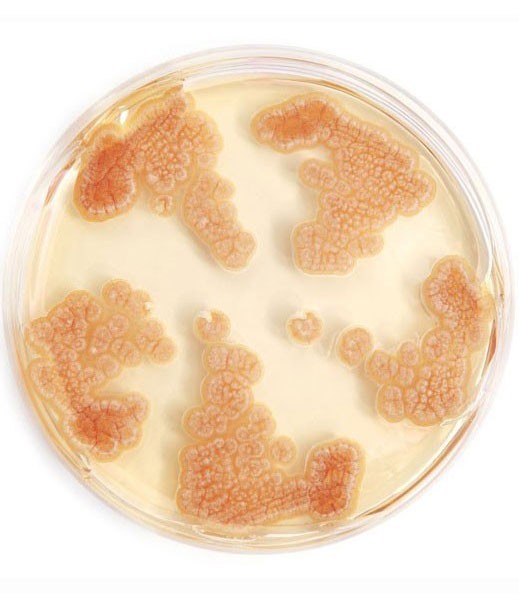 Penicillin mould in a glass dish