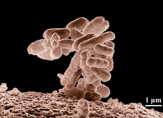 E. coli bacteria, magnified 10,000 times