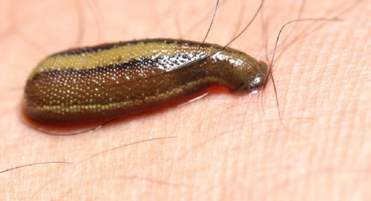 Leeches were used in blood-letting