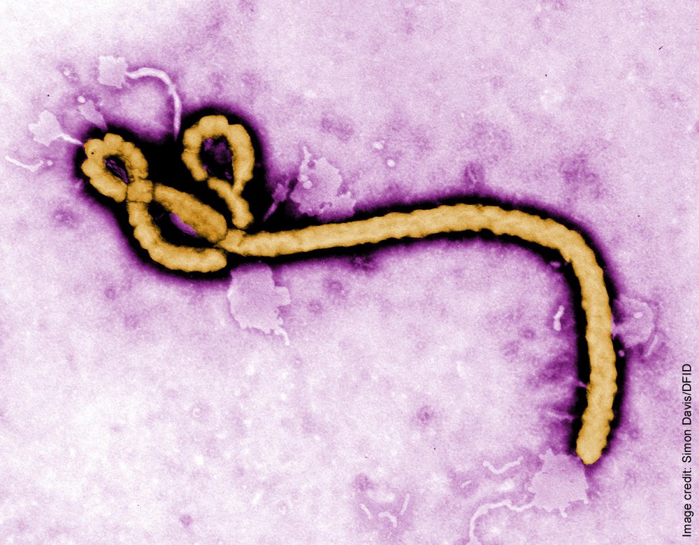 A micrograph (TEM) of an ebolavirus