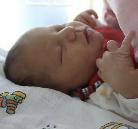 The Moro reflex while sleeping
