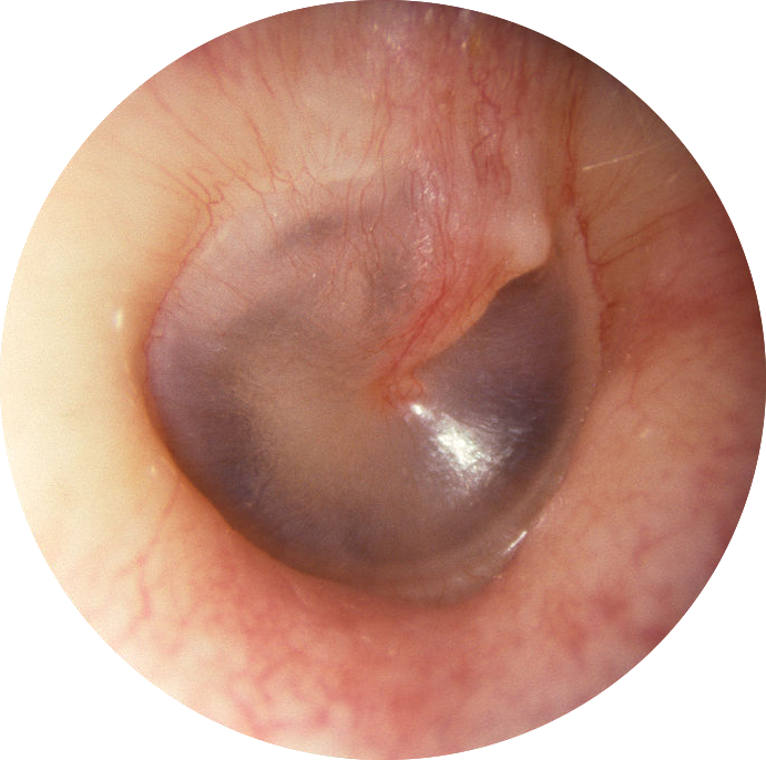 The outside of the eardrum