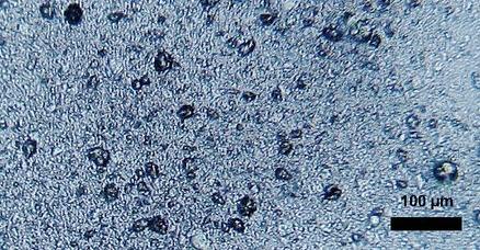 Microplastic particles in toothpaste