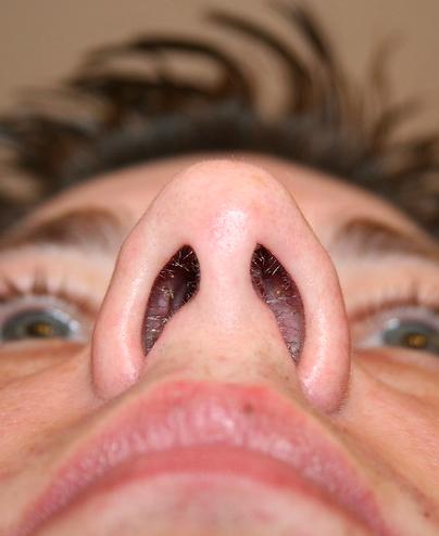 Hairs inside the nostrils