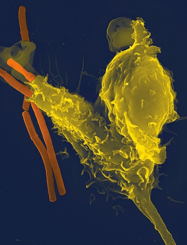 Micrograph of a neutrophil engulfing anthrax bacteria