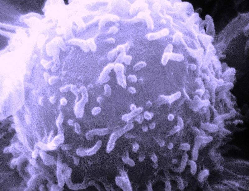 Micrograph of a lymphocyte