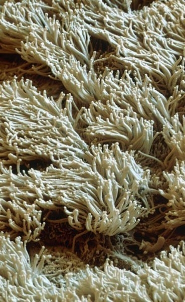 Micrograph of the cilia lining the inside of the nose