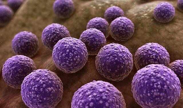 Staphylococcus aureus causes skin infections.