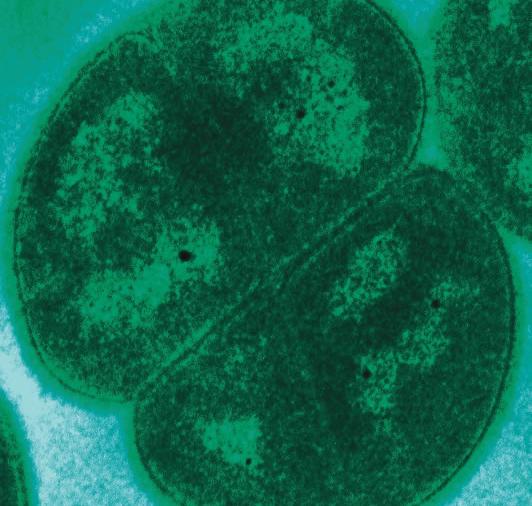 Deinococcus radiodurans