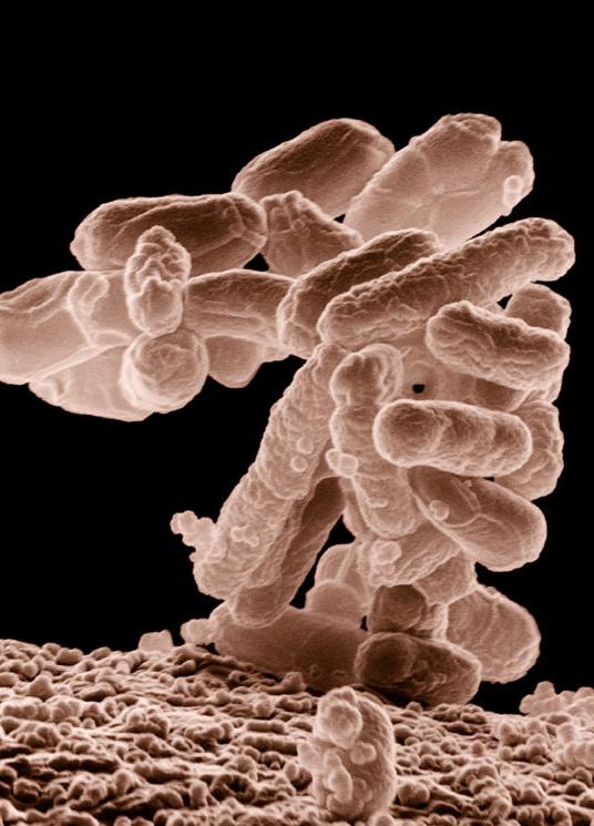 E. coli bacteria can cause serious food poisoning
