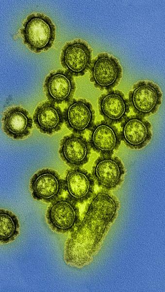 Influenza (flu) virus particles