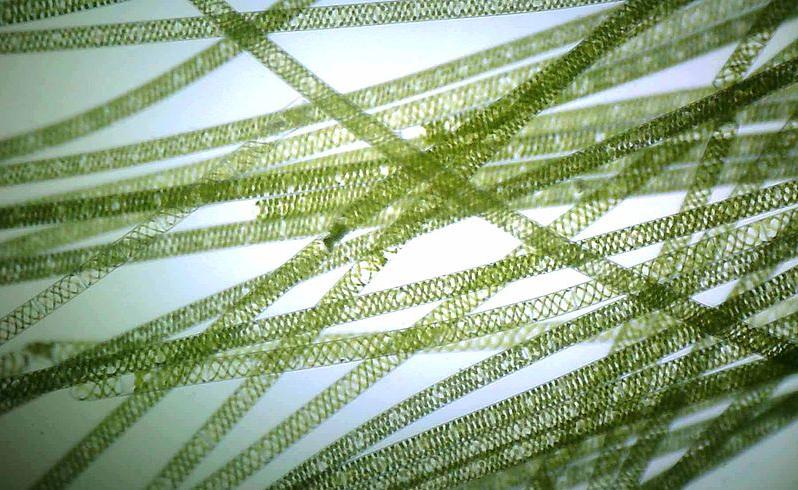 Spirogyra, a kind of algae. Its cells join up to form long strands