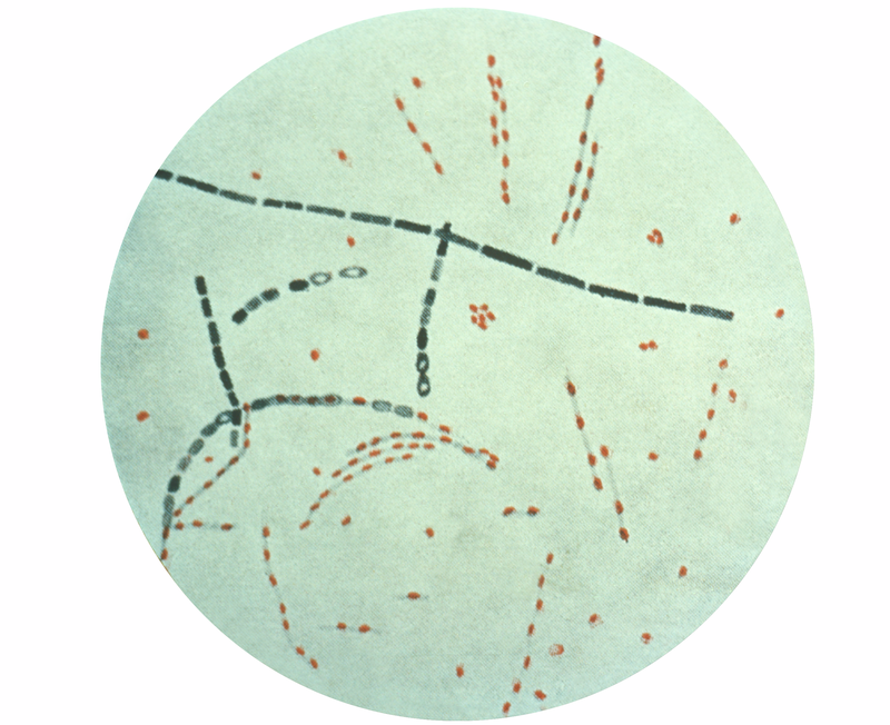 Bacillus anthracis, the bacterium that causes anthrax