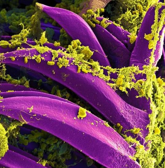 Y. pestis bacteria among the spines of a rat flea