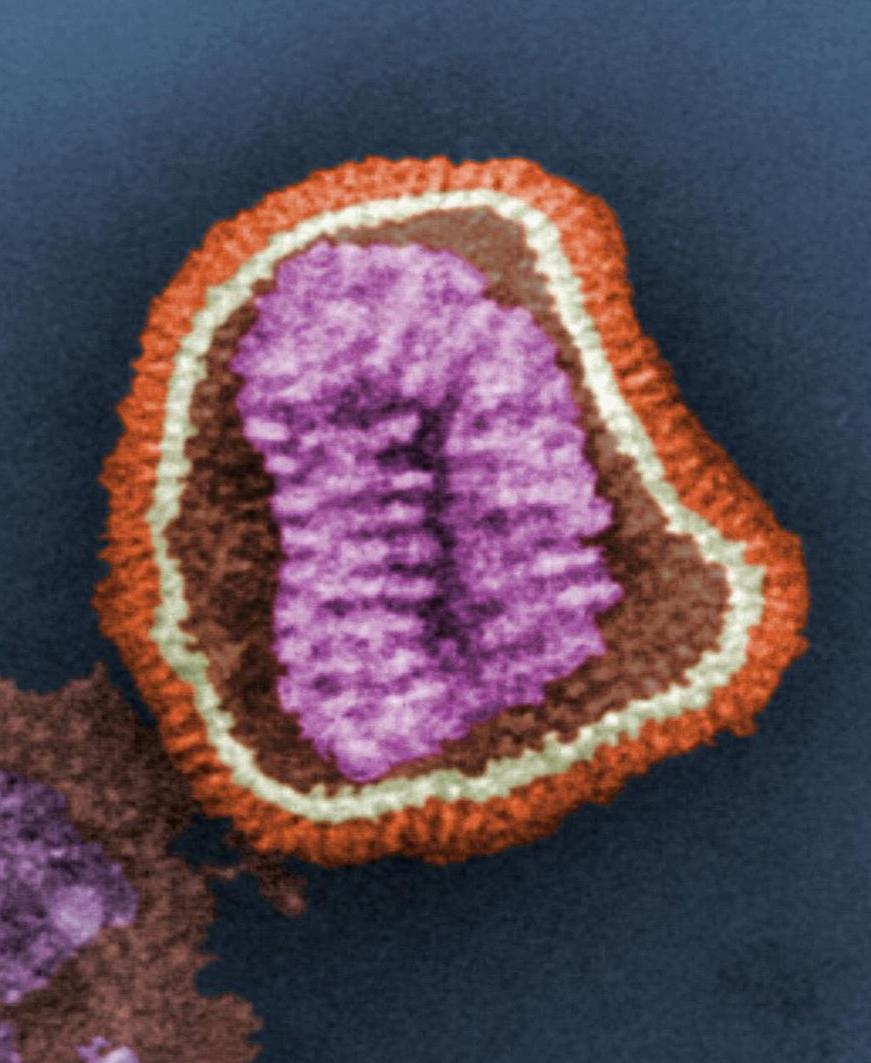 Micrograph of an influenzavirus