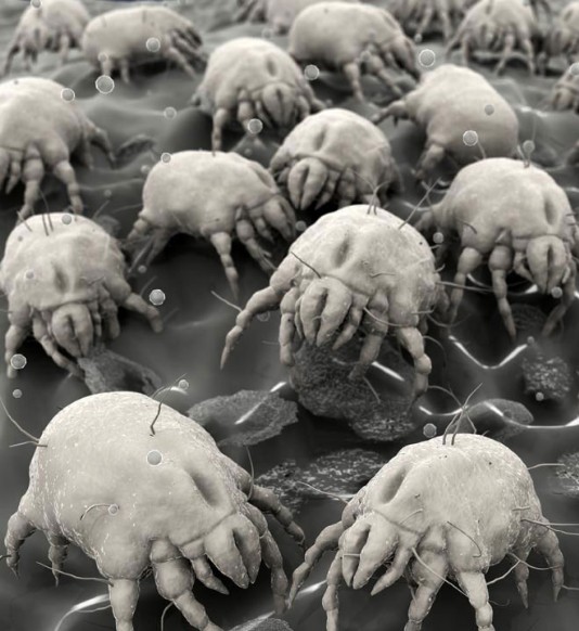 Dust mites seen through a microscope