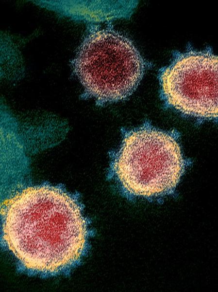 Sars-CoV-2 viruses imaged by an electron microscope
