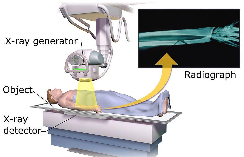 Diagram showing how an X-ray is carried out