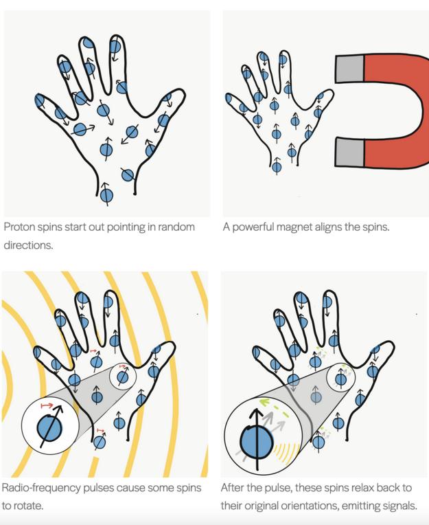 Diagram explaining how MRI works