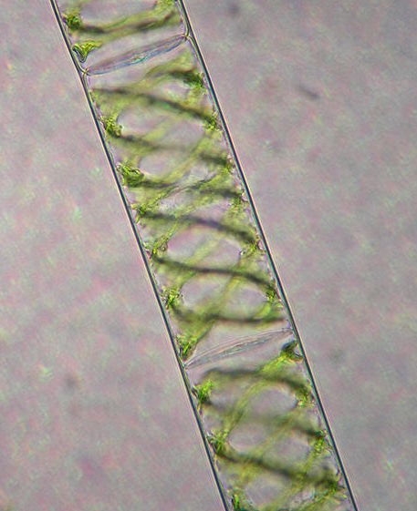 Spirogyra, a kind of green algae