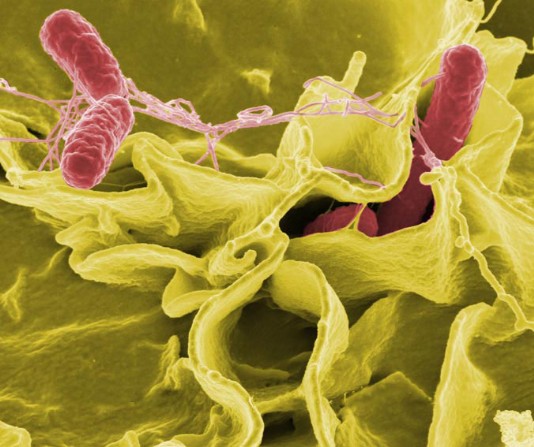 Salmonella bacteria (red) invading human cells