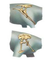 Hip bones
